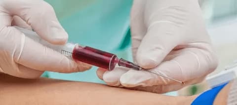 سرنگ خونگیری جدید مناسب استفاده در مراکز درمانی و آزمایشگاهی